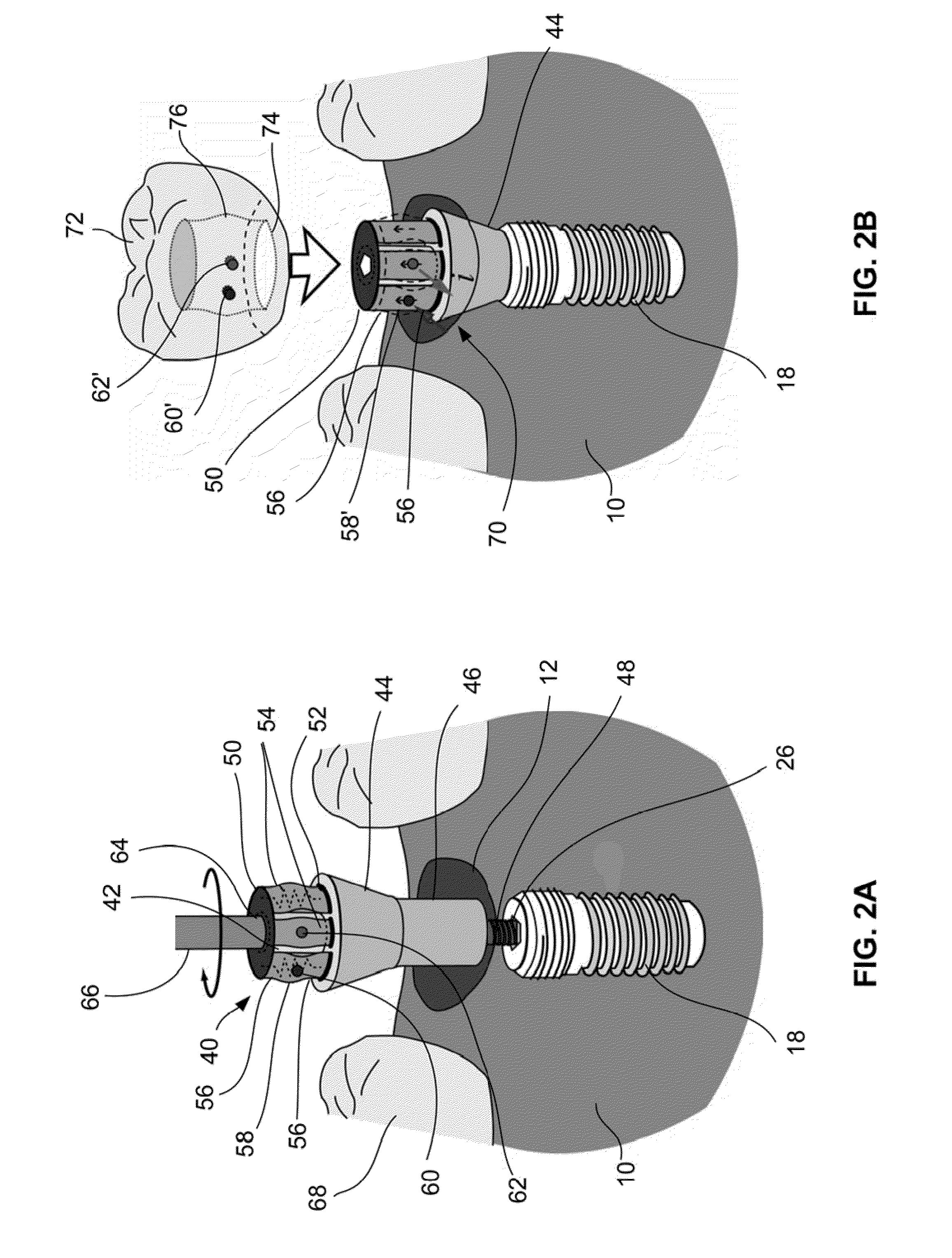 Oral appliance activation devices and methods