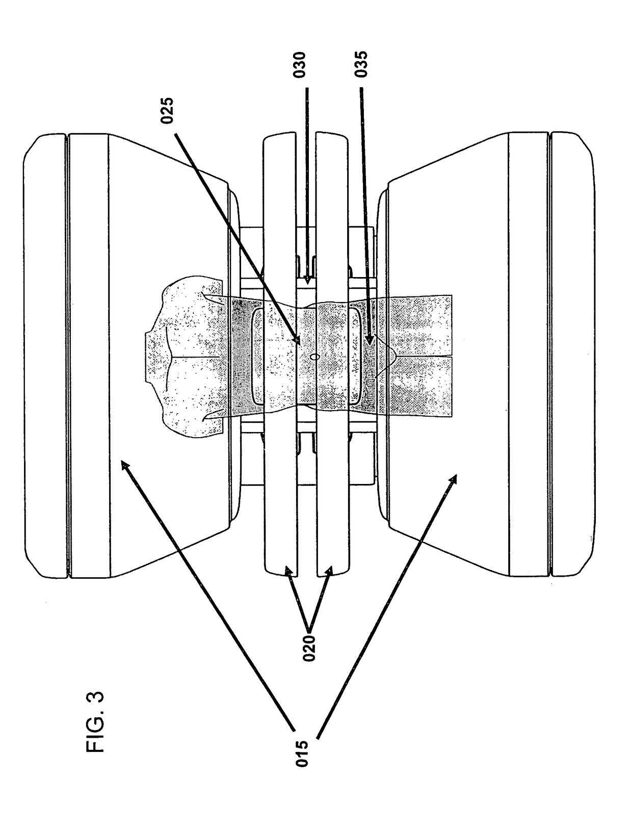 System for delivering conformal radiation therapy while simultaneously imaging soft tissue