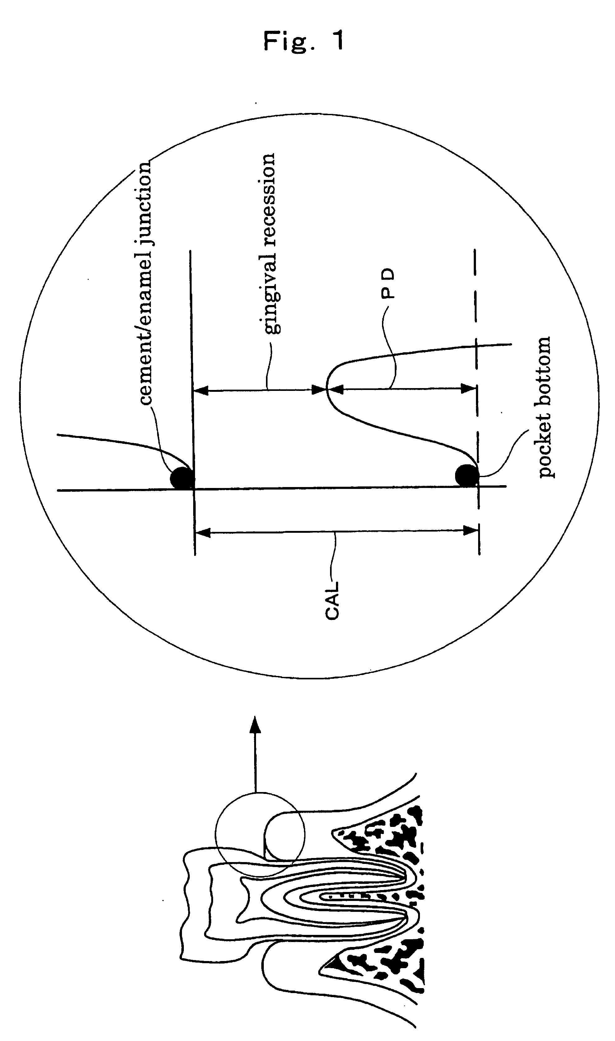 Method of inhibiting alveolar bone resorption and periodontal membrane loss and composition for internal use to be used therein