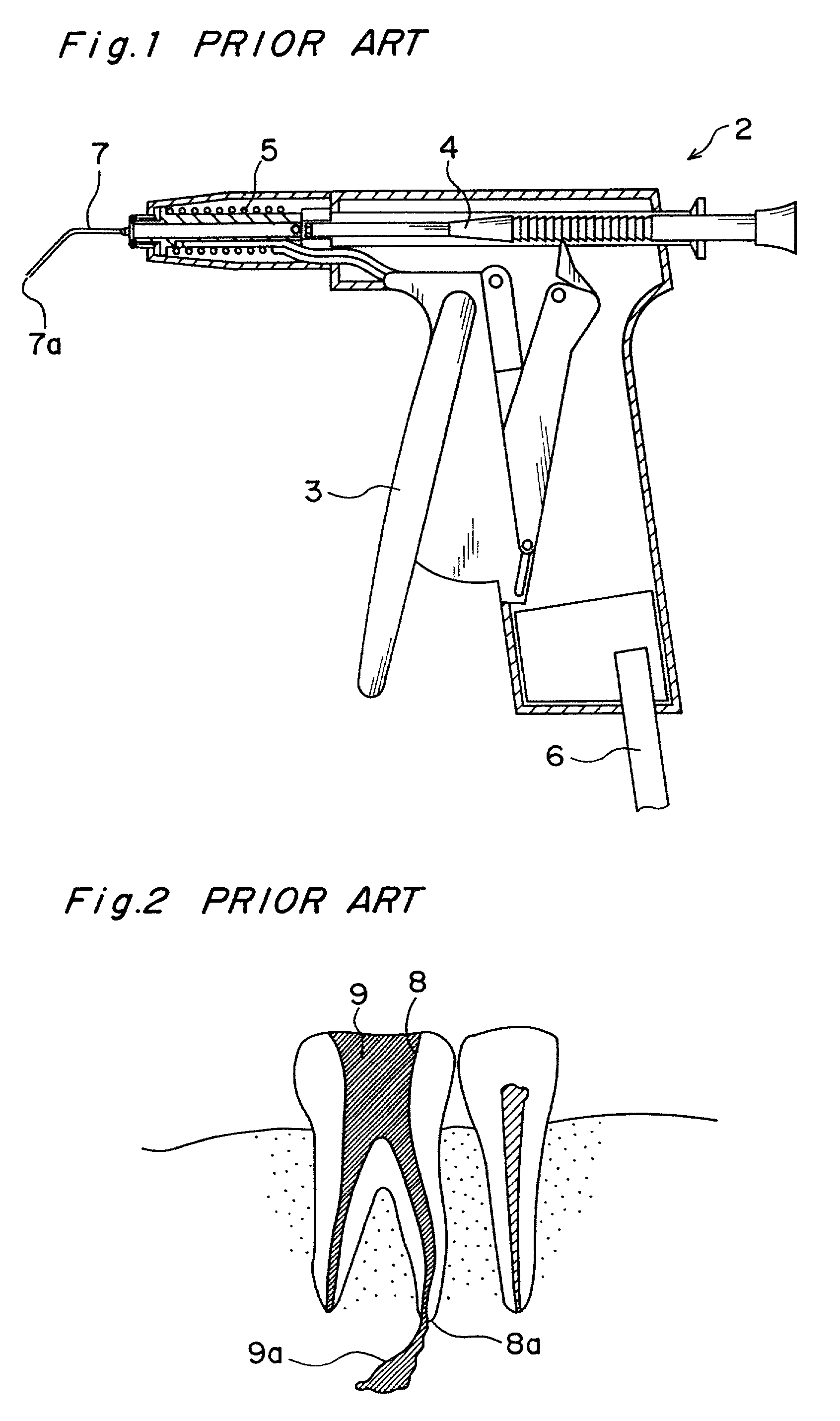 Dental filling instrument and attachment therefor