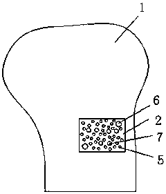 Bone tumor prosthesis for firmly connecting tendon and making method thereof