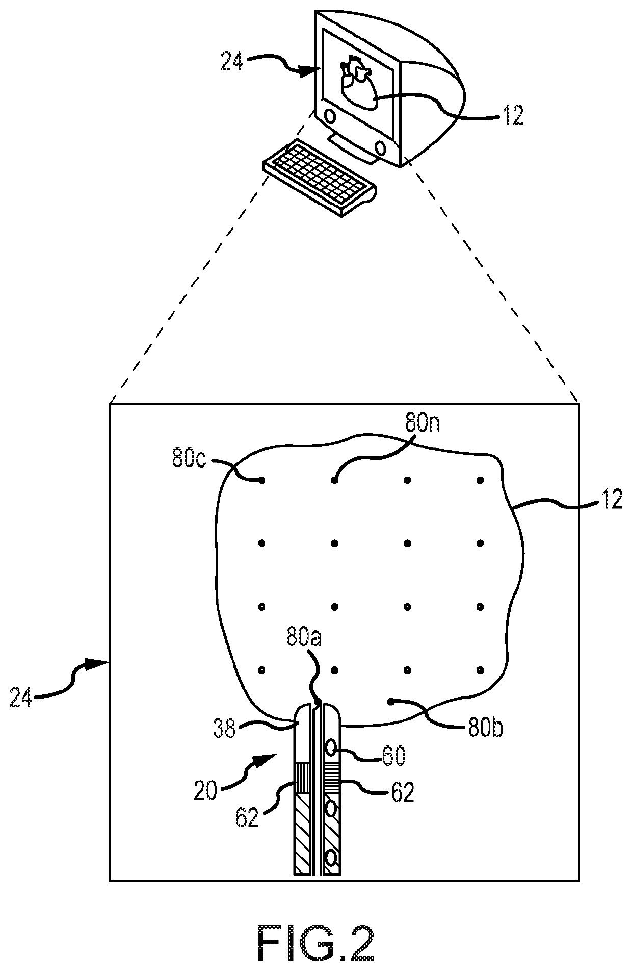 Biologic delivery system with positional sensing and force sensing