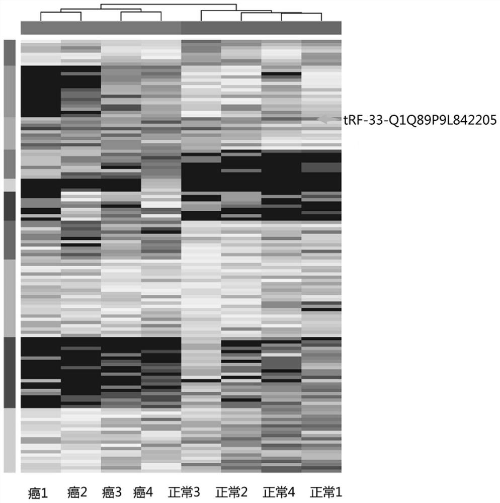 Application of tRF expression primer in detection tissue in preparation of laryngeal cancer auxiliary diagnosis kit