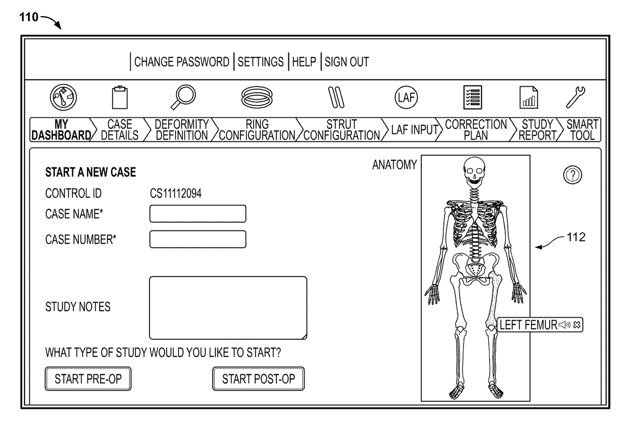 Software for use with deformity correction