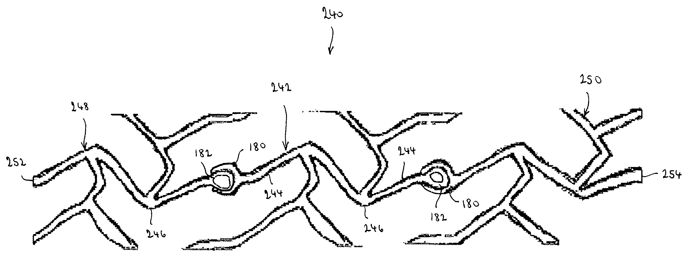 Modular vascular prosthesis and methods of use