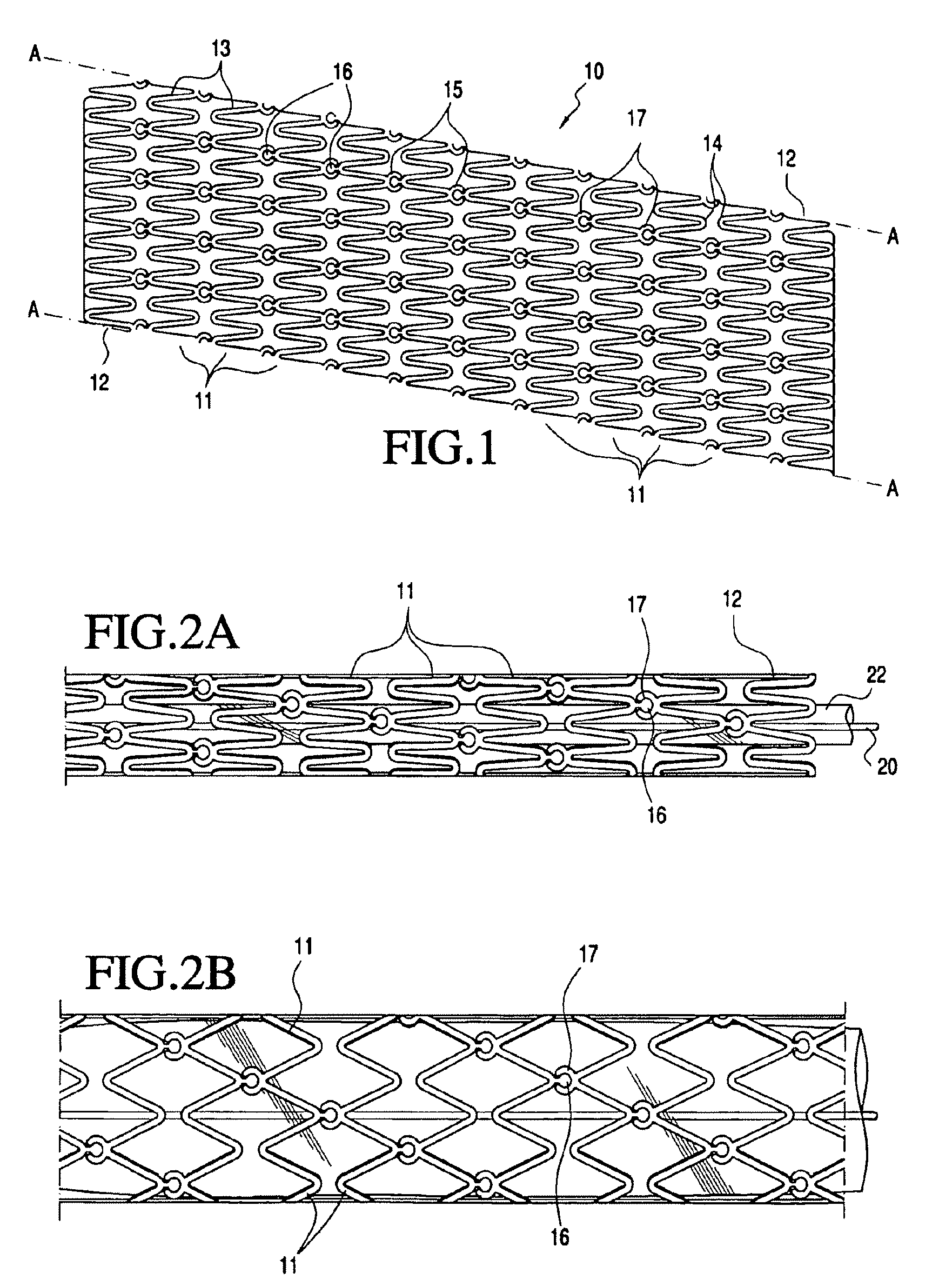 Modular vascular prosthesis and methods of use