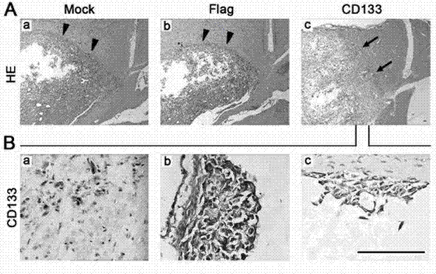 Use of CD133 in preparation of tumor marker and kit of CD133