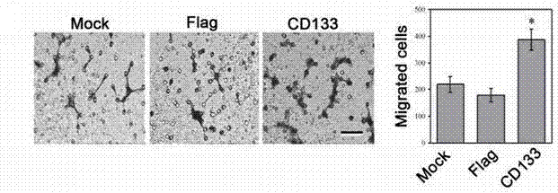 Use of CD133 in preparation of tumor marker and kit of CD133