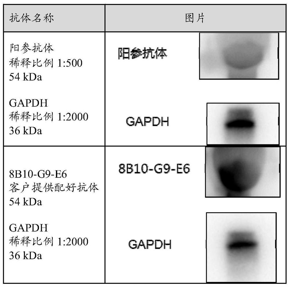 Antibody cBIN1 and application thereof