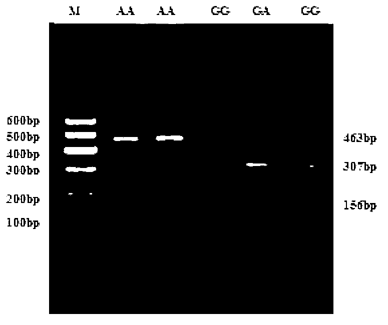 Method for detecting cattle Vaspin gene single nucleotide polymorphism and application of method