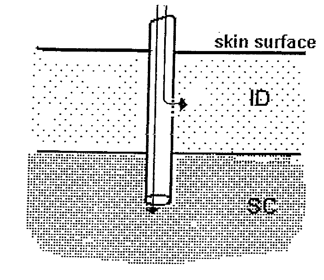 Method and device for controlling drug pharmacokinetics