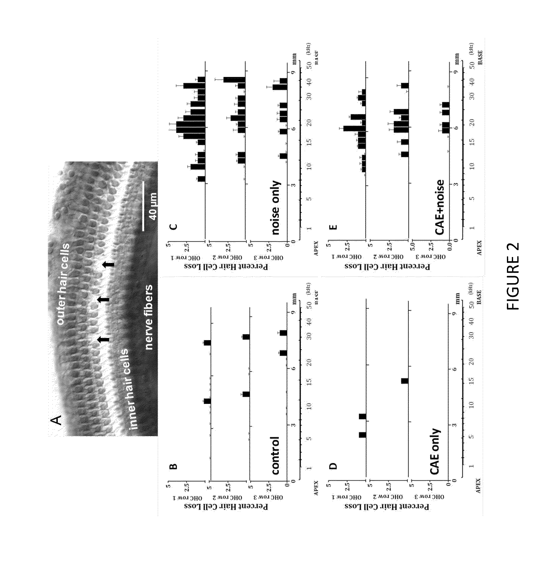 Methods and compositions for preventing and treating auditory dysfunctions