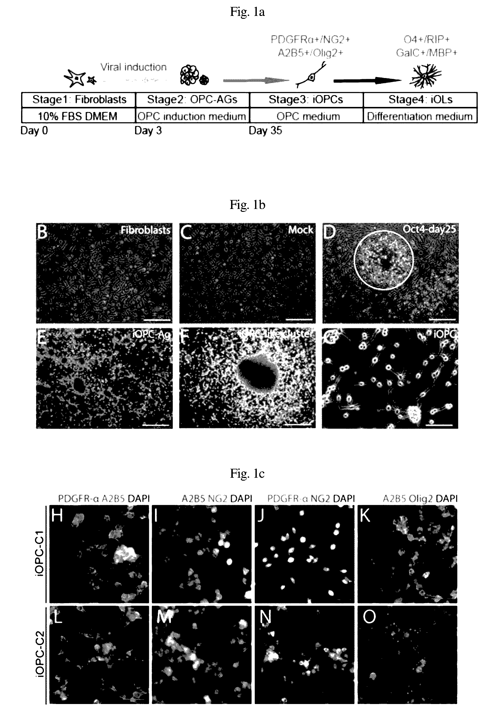 Composition for inducing direct transdifferentiation into oligodendrocyte progenitor cells from somatic cells and use thereof