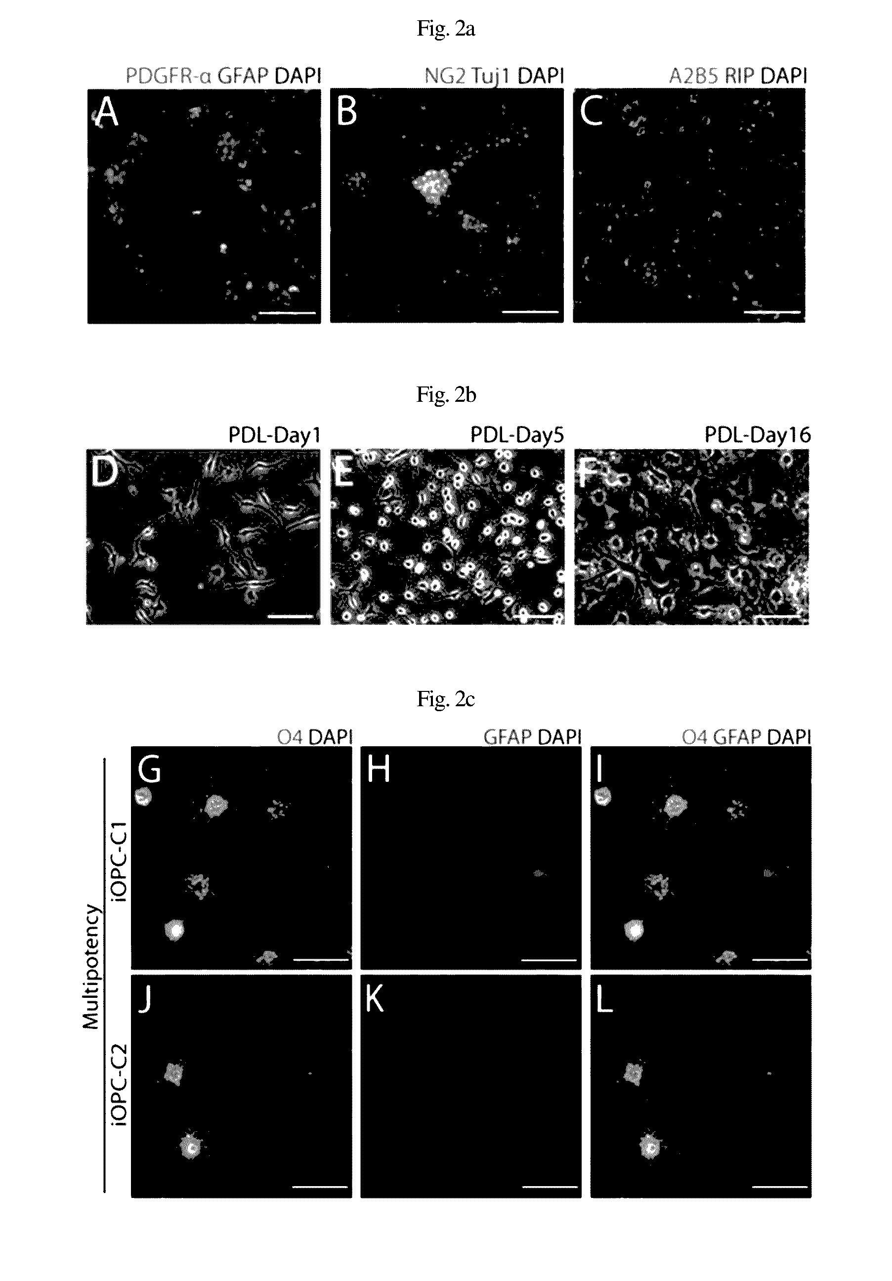 Composition for inducing direct transdifferentiation into oligodendrocyte progenitor cells from somatic cells and use thereof
