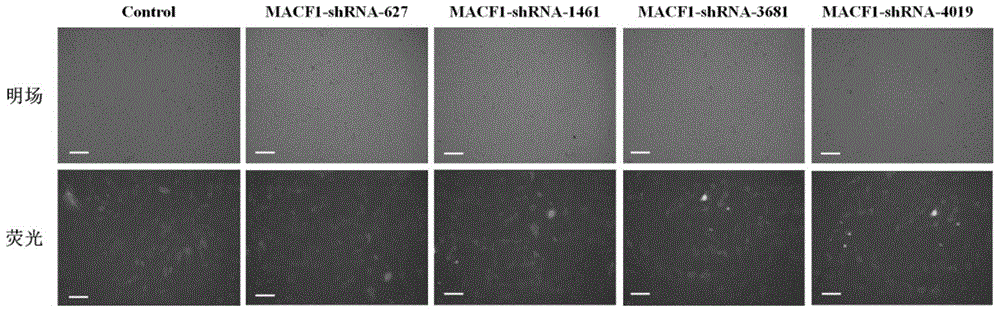 Shrna sequence and application thereof for inhibiting expression of mouse macf1 gene