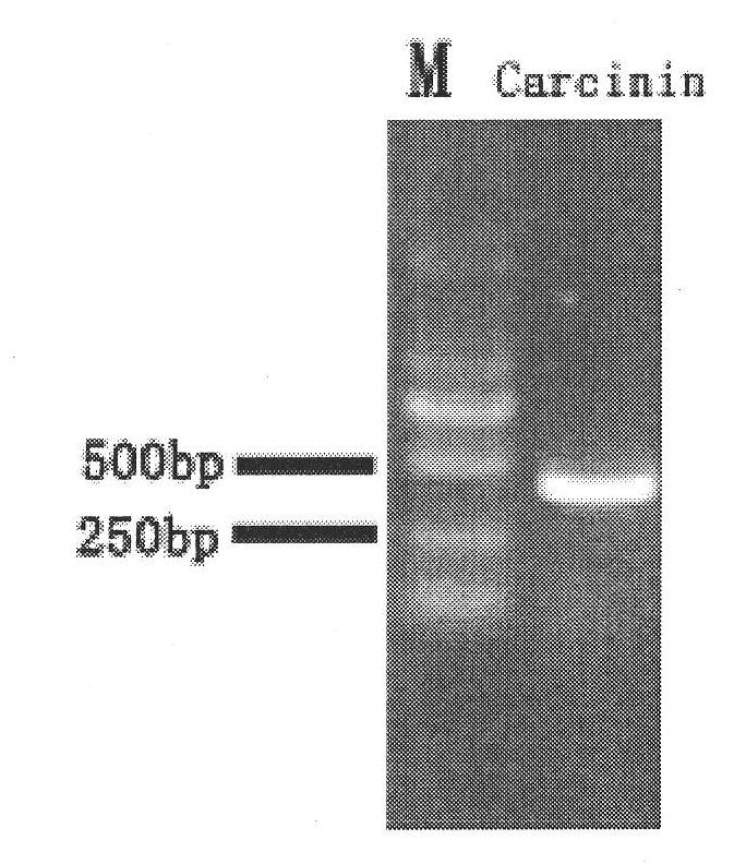 Antibacterial protein and its coding gene, expression system, refolding system and application