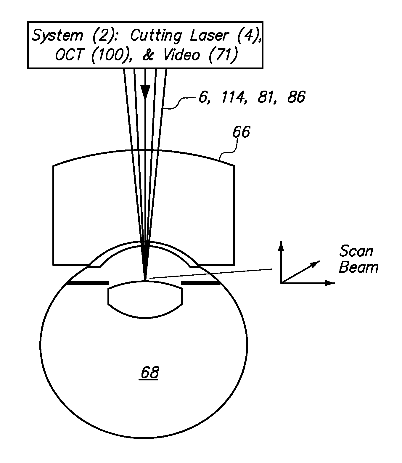 Method and apparatus for automated placement of scanned laser capsulorhexis incisions