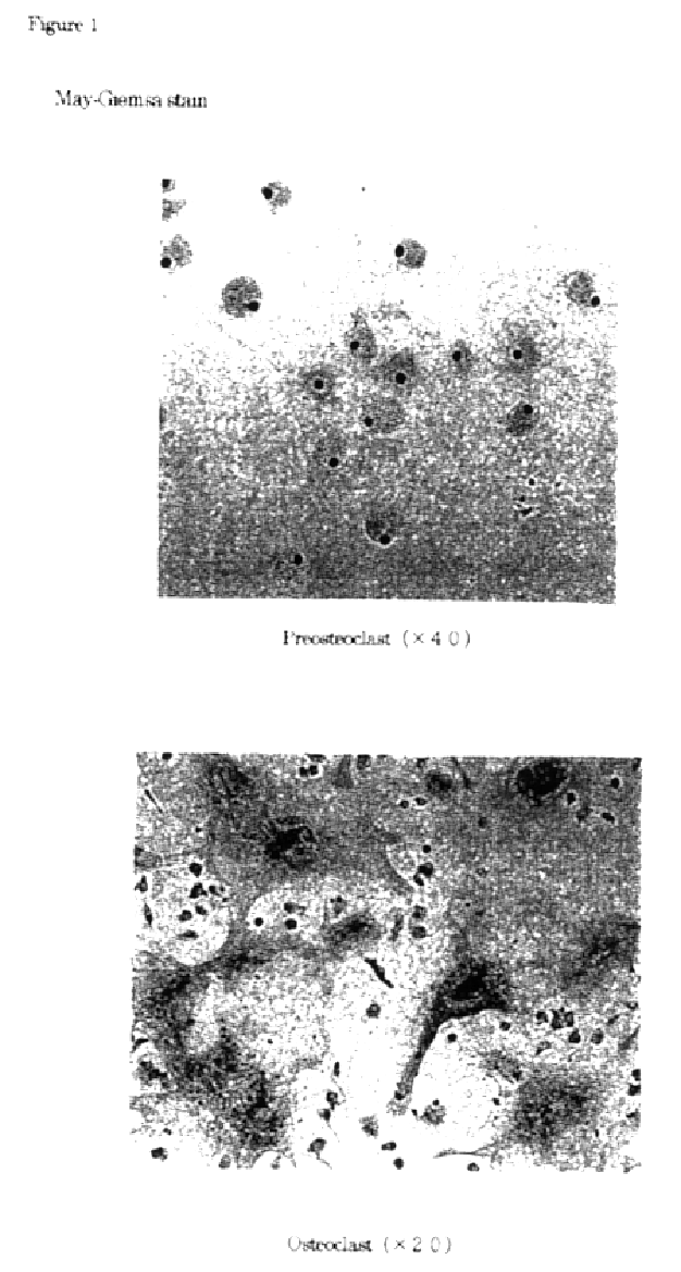 Methods for isolation of osteoclast precursor cells and inducing their differentiation into osteoclasts