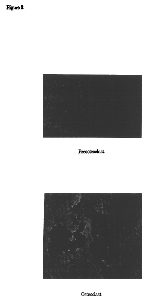 Methods for isolation of osteoclast precursor cells and inducing their differentiation into osteoclasts