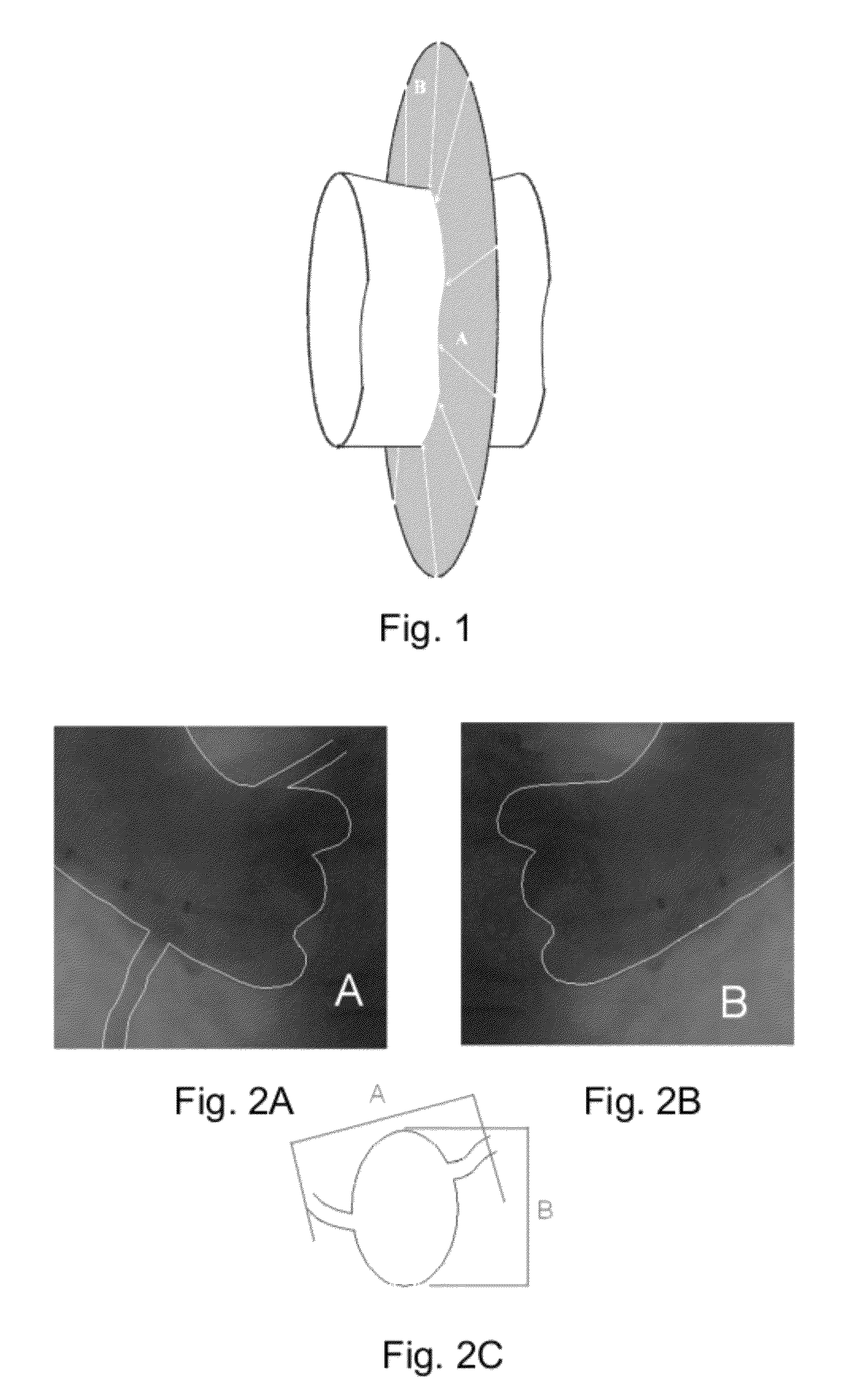 Method and apparatus for determining optimal image viewing direction