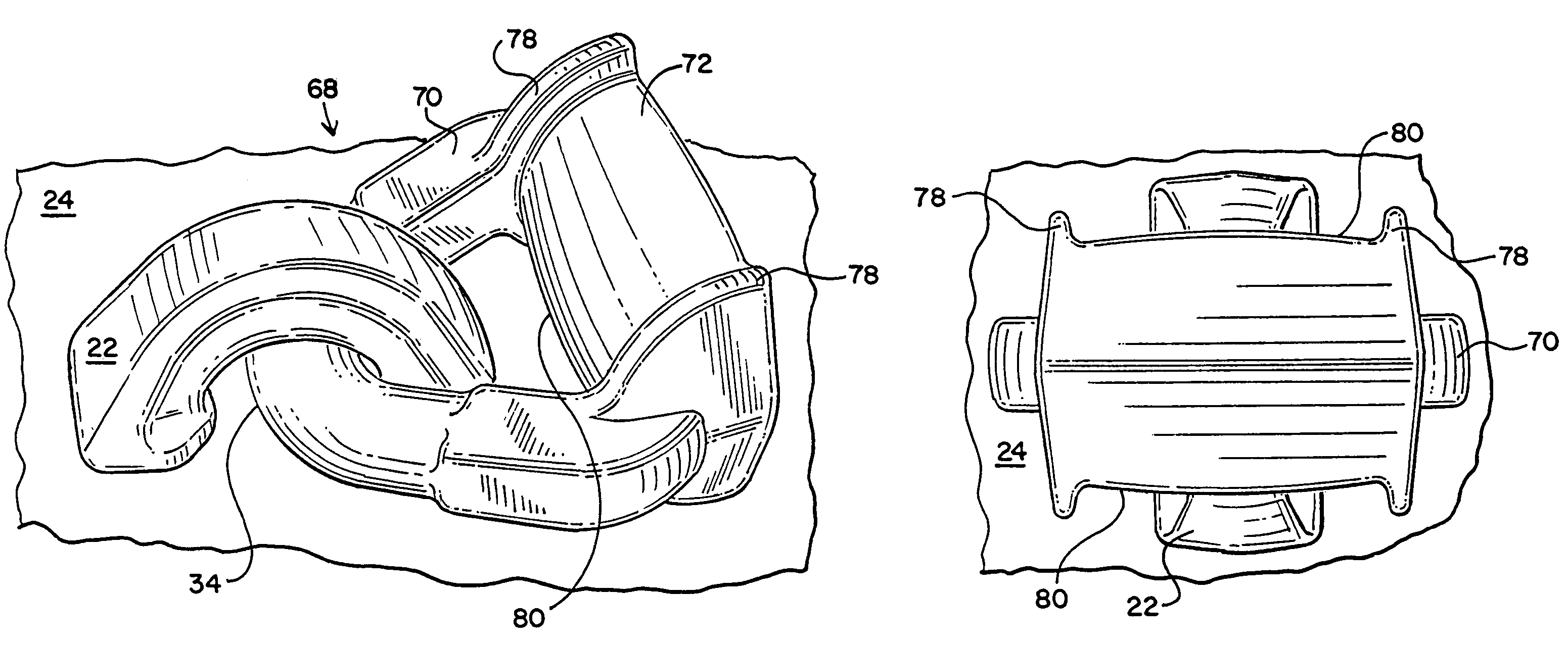 Lading tie anchor link with enhanced banding contact surface