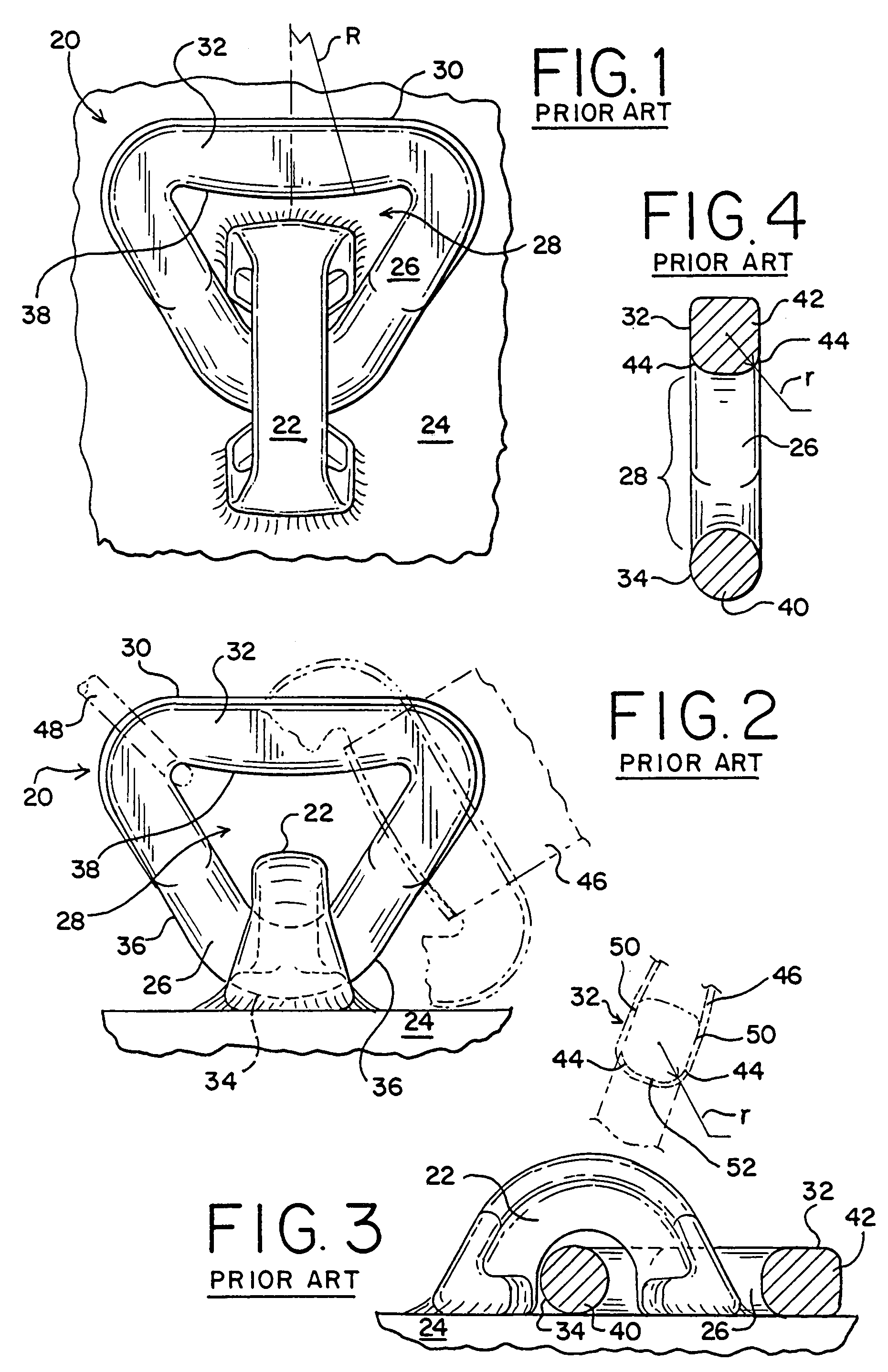 Lading tie anchor link with enhanced banding contact surface