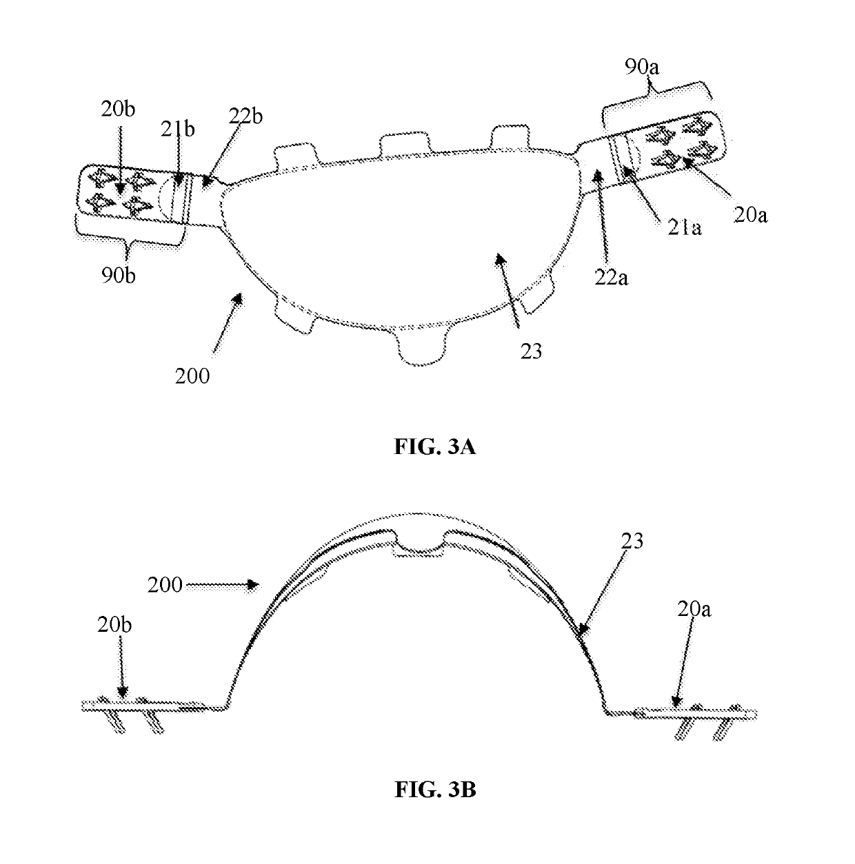 Implantable fastener for attachment of a medical device to tissue