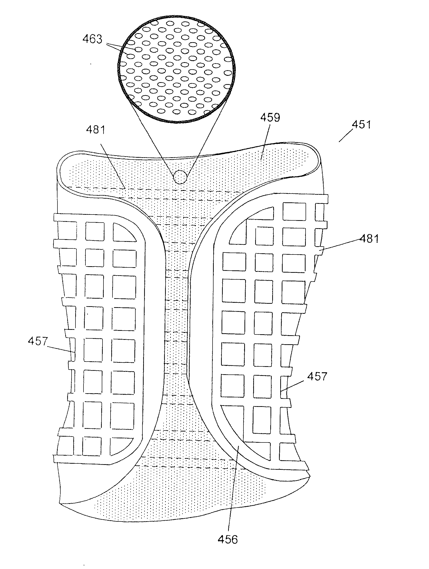 Custom braces, casts and devices having fenestrations and methods for designing and fabricating