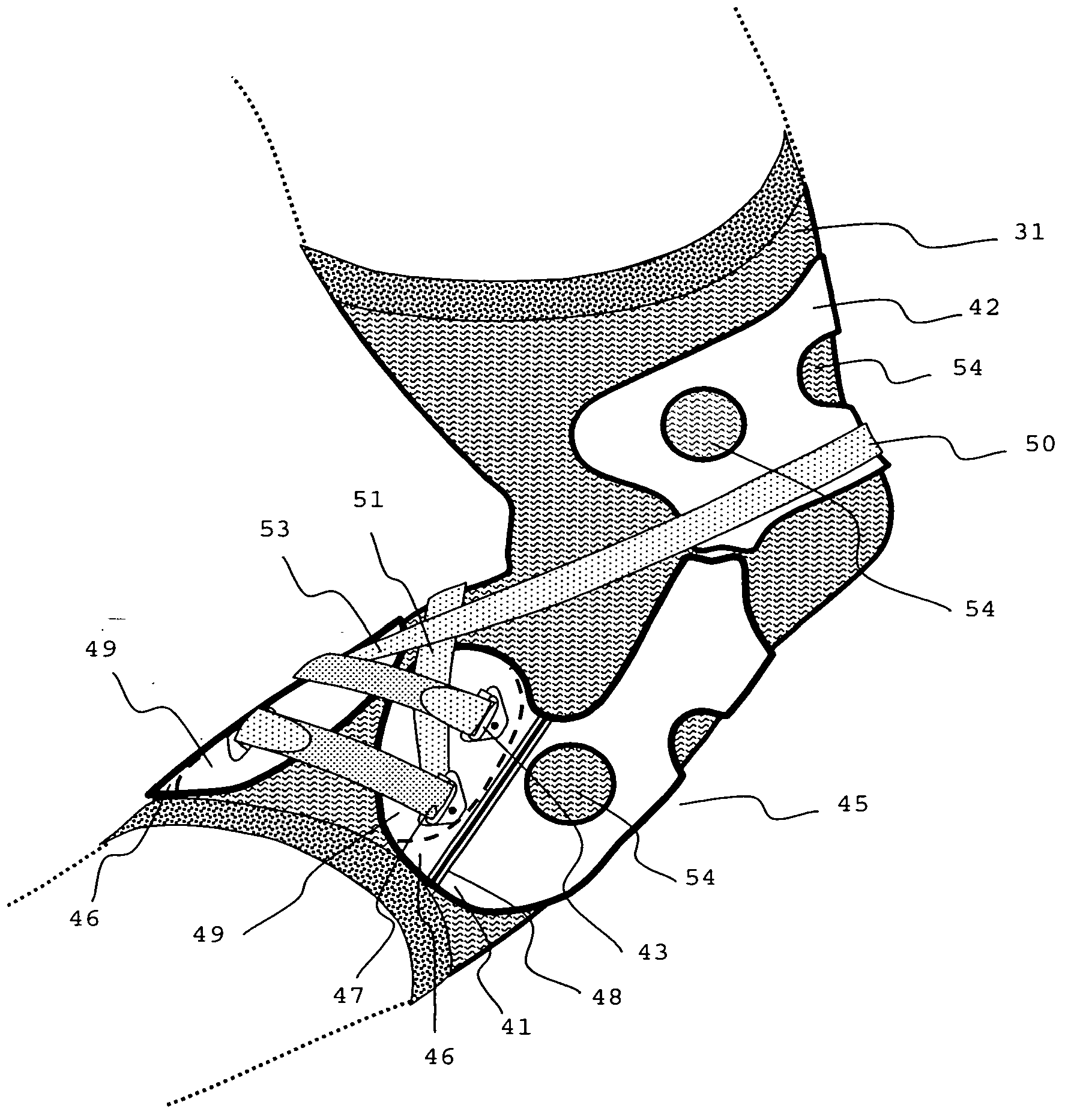 Orthosis for movement damping