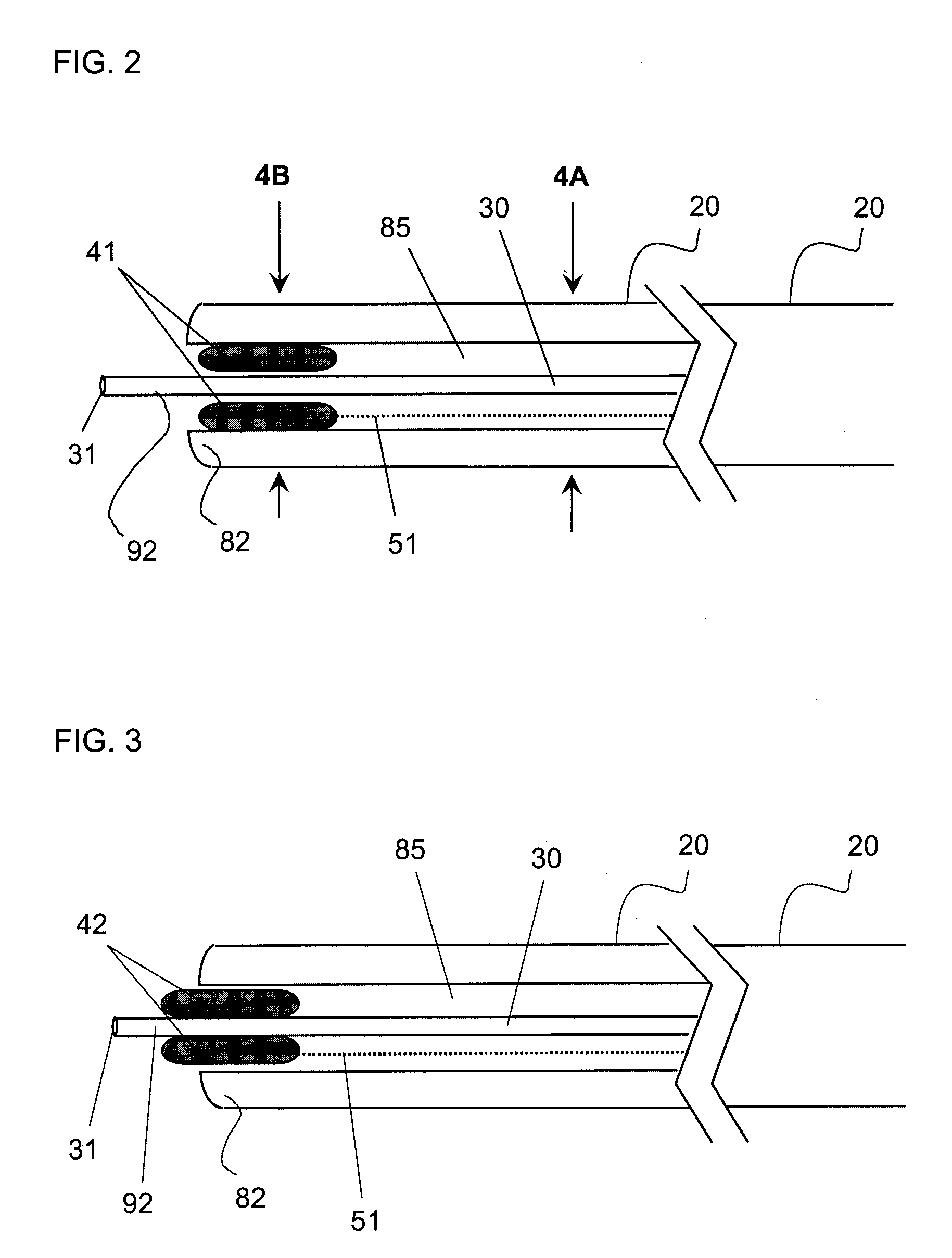 Apparatus and method for guided chronic total occlusion penetration