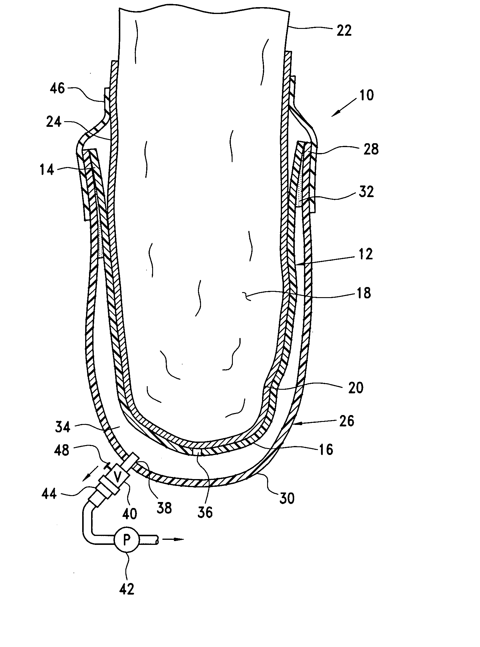 Prosthetic socket with self-contained vacuum reservoir