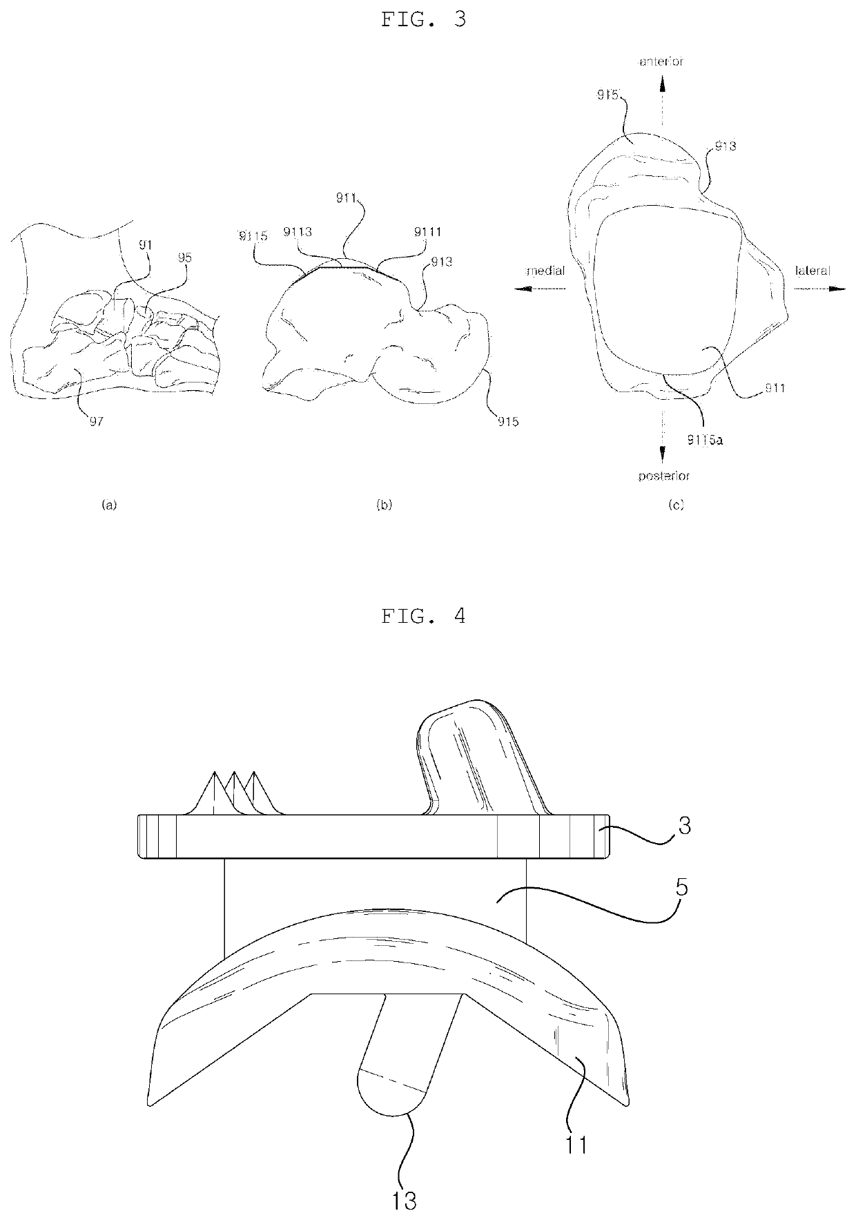 Artificial ankle joint talus component