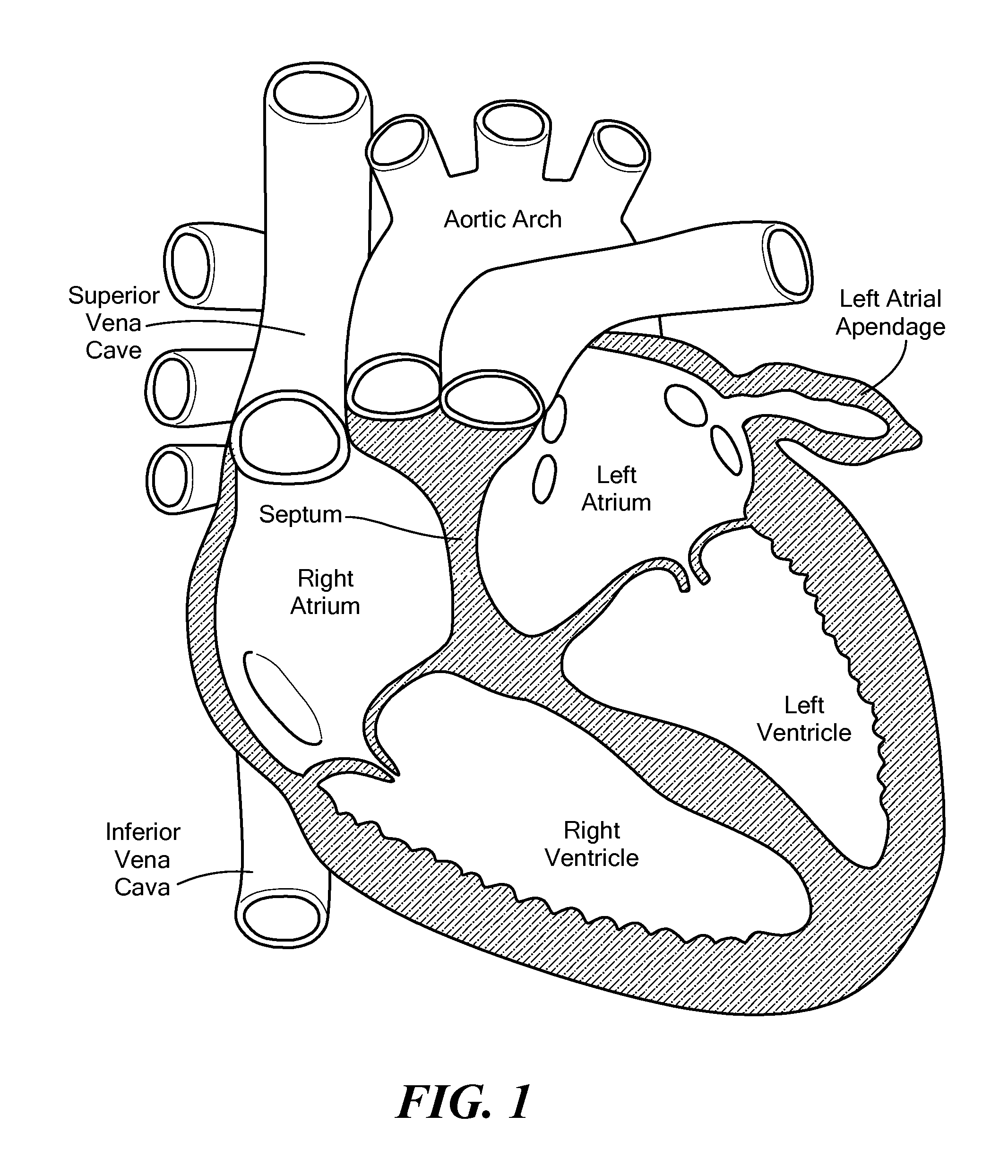 Cryoadhesive device for left atrial appendage occlusion