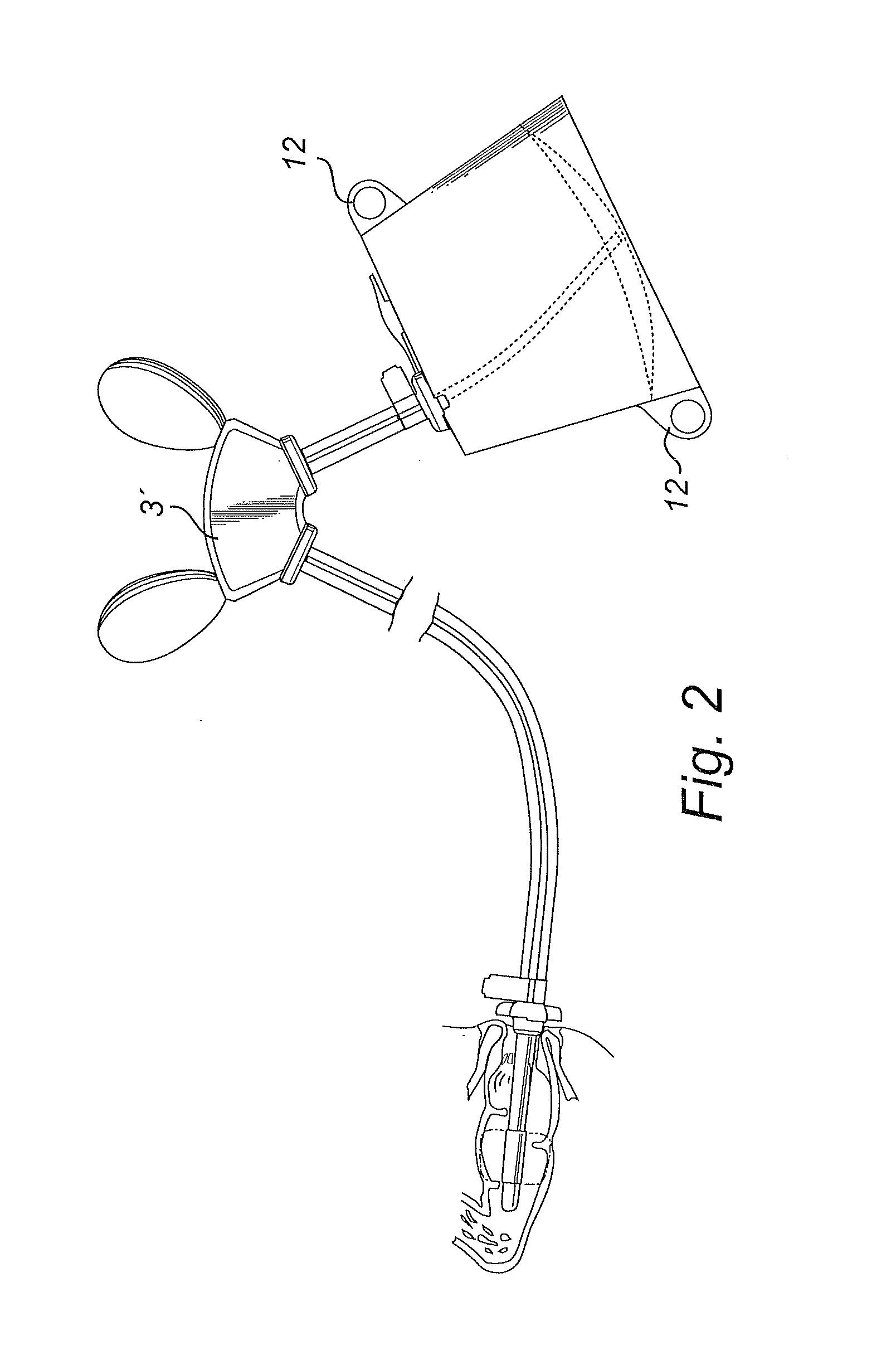 Irrigation system comprising dual pumps