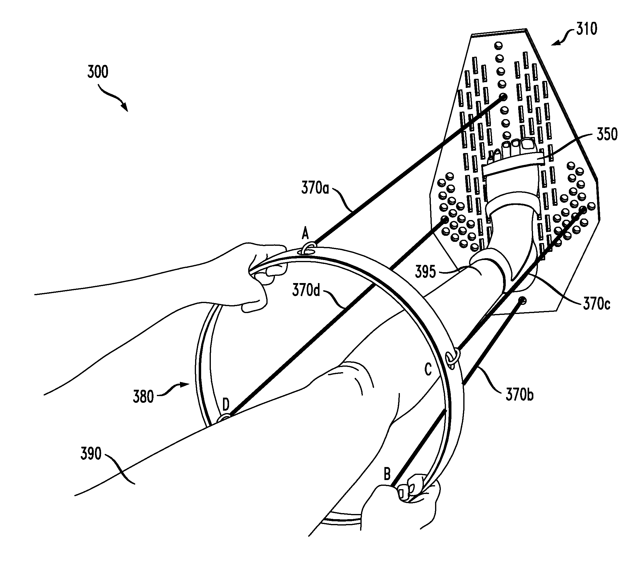 Orthopedic rehabilitation mechanism employing a foot support having a first portion and a second portion configured to rotate with respect to one another