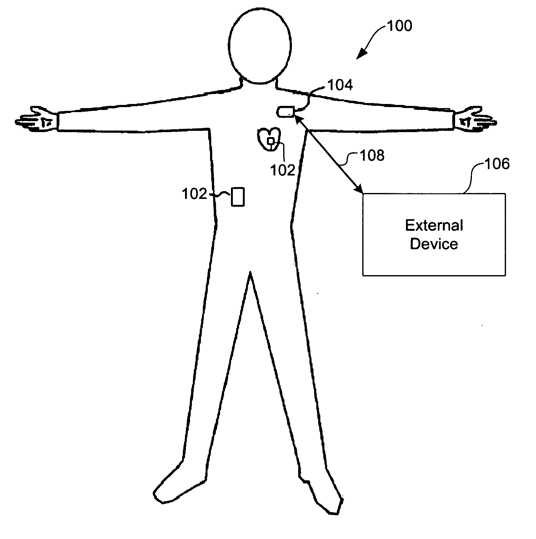 Systems and methods for timing-based communication between implantable medical devices