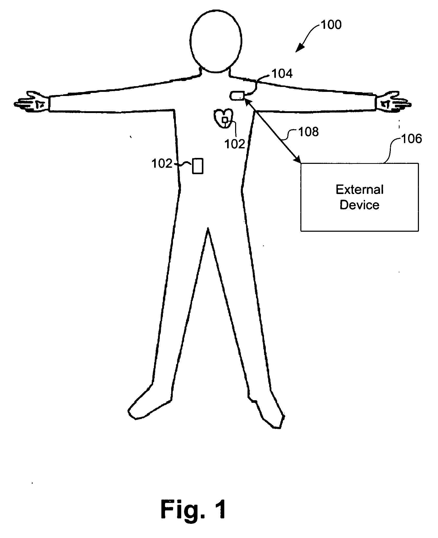 Systems and methods for timing-based communication between implantable medical devices