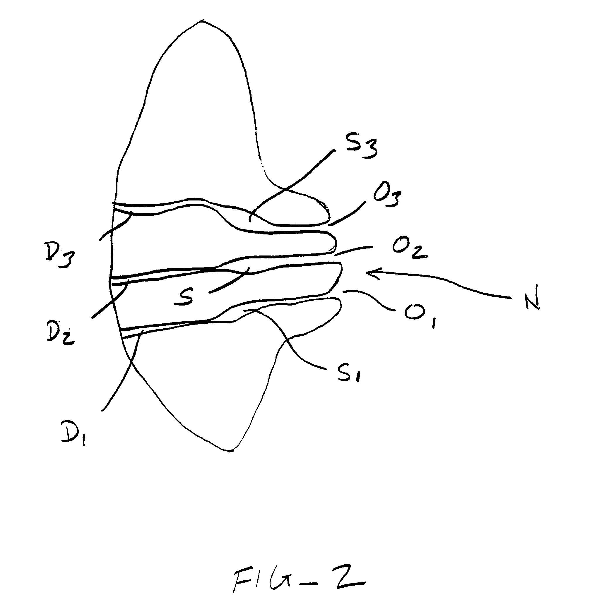 Methods and kits for indentifying ductal orifices in a nipple