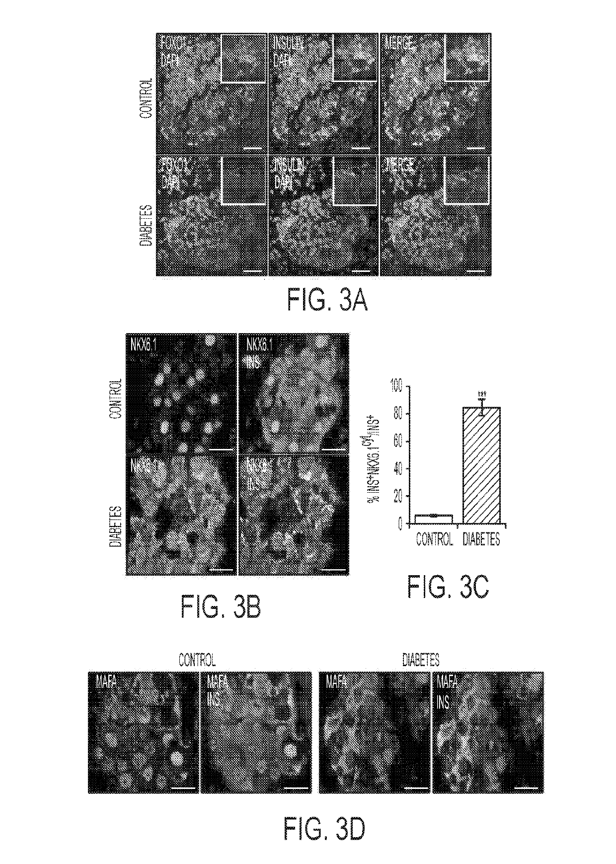 Use of aldehyde dehydrogenase as biomarker for beta-cell dysfunction and loss