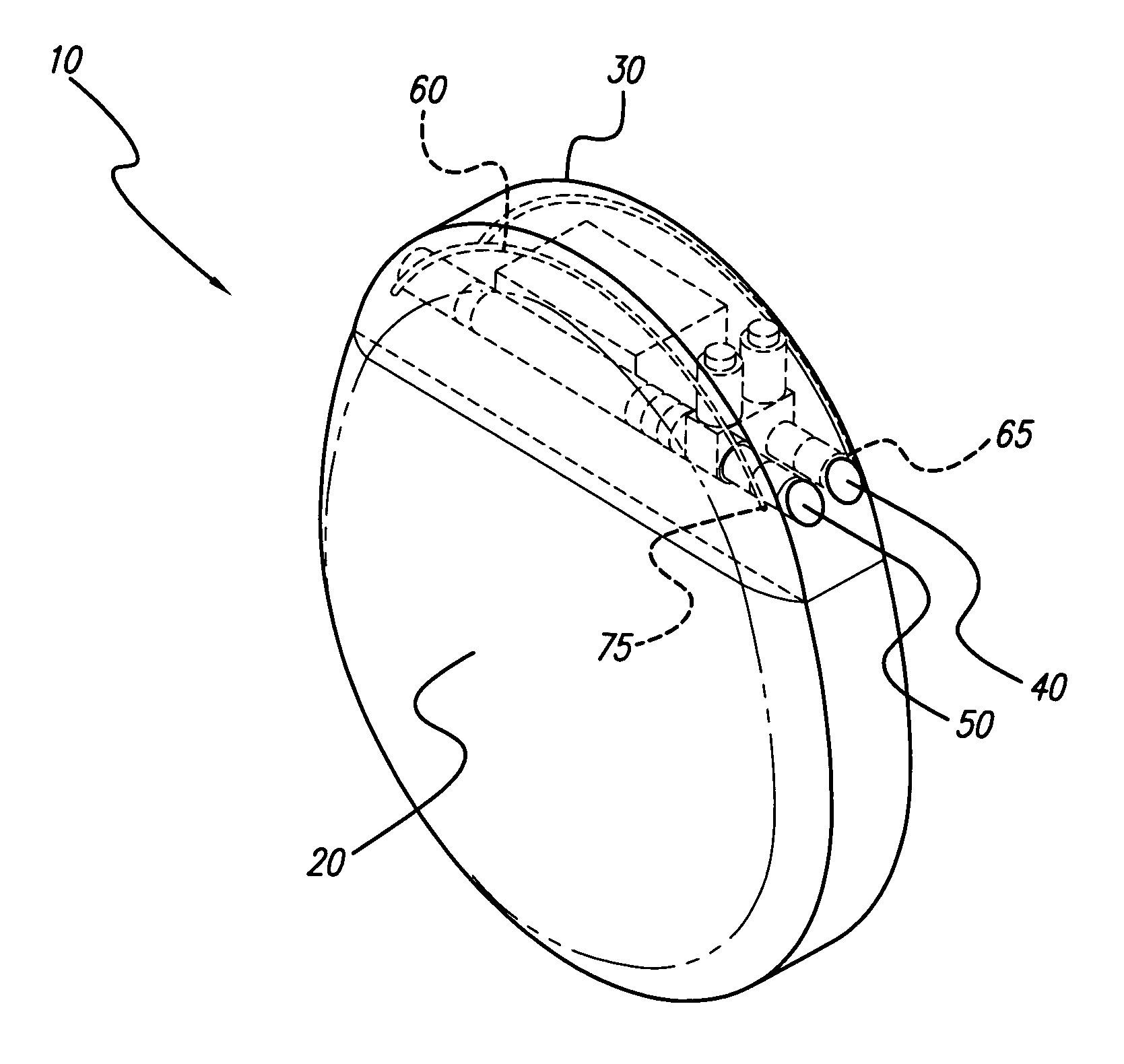 Folded monopole antenna for implanted medical device