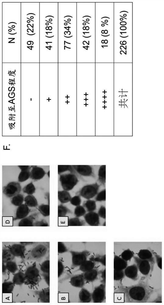 A lactic acid bacteria composition for inhibiting gastric Helicobacter pylori-induced gastritis and its application