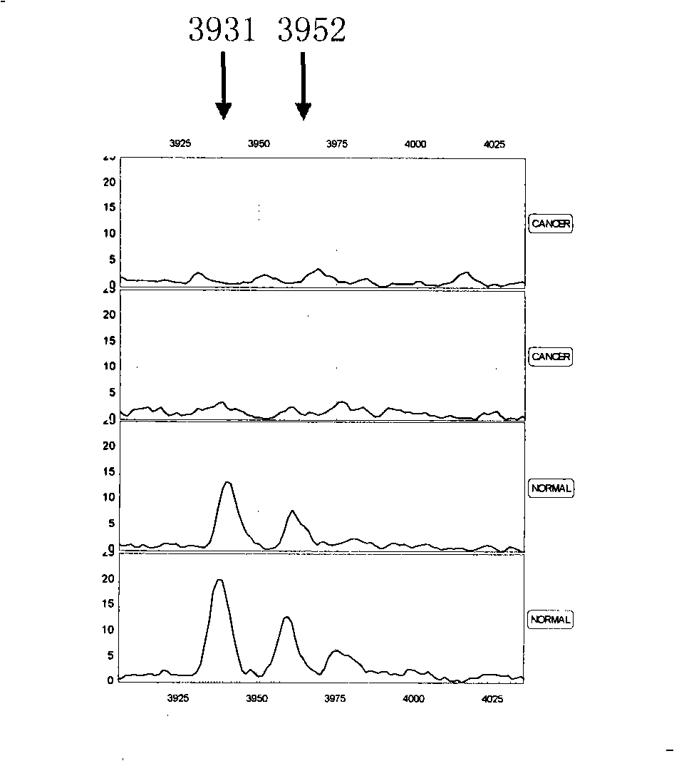 Optimizing mass spectrogram model for detecting kidney cancer characteristic protein and preparation method and application thereof