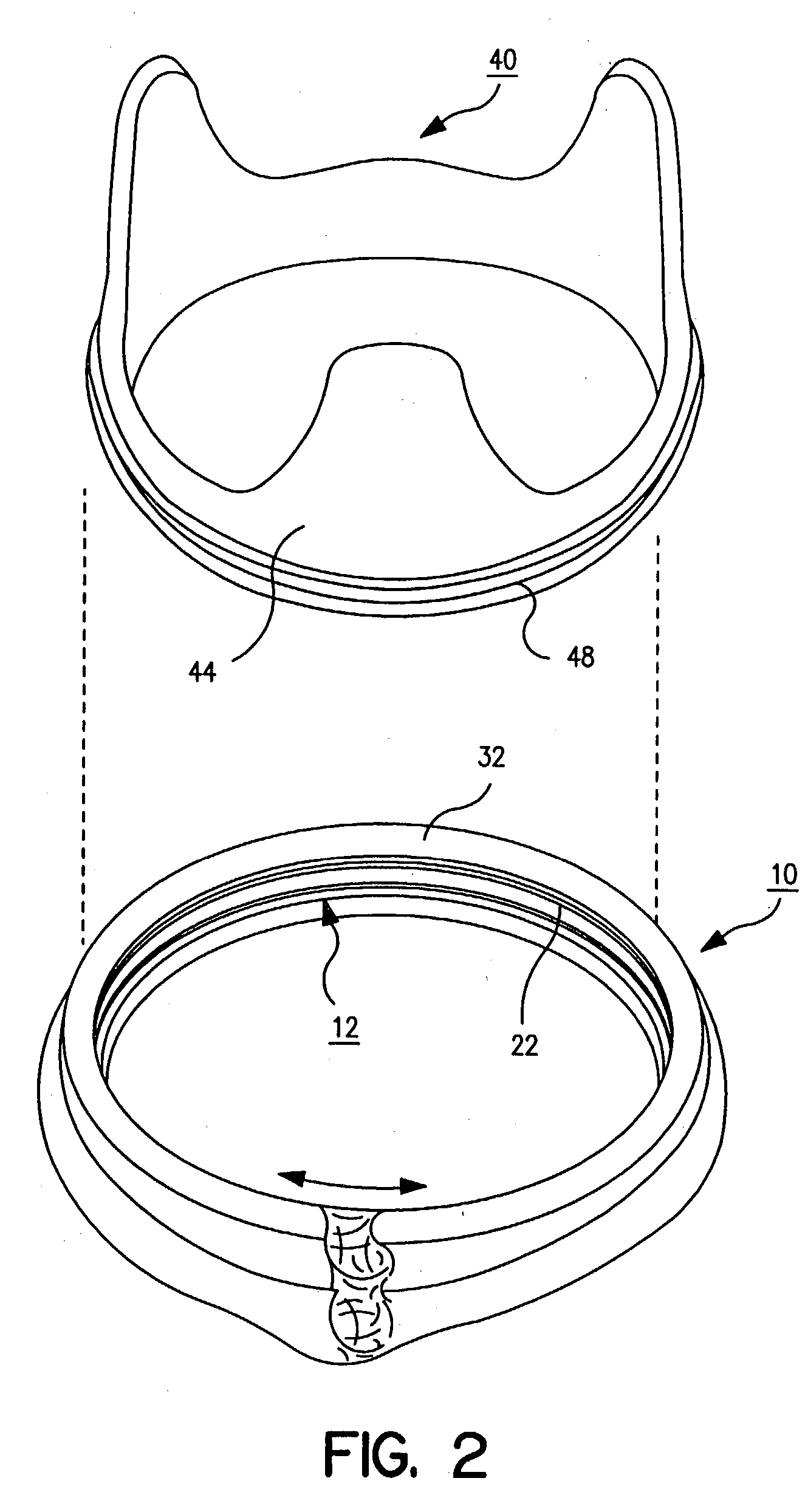 Suturing rings for implantable heart valve prosthesis