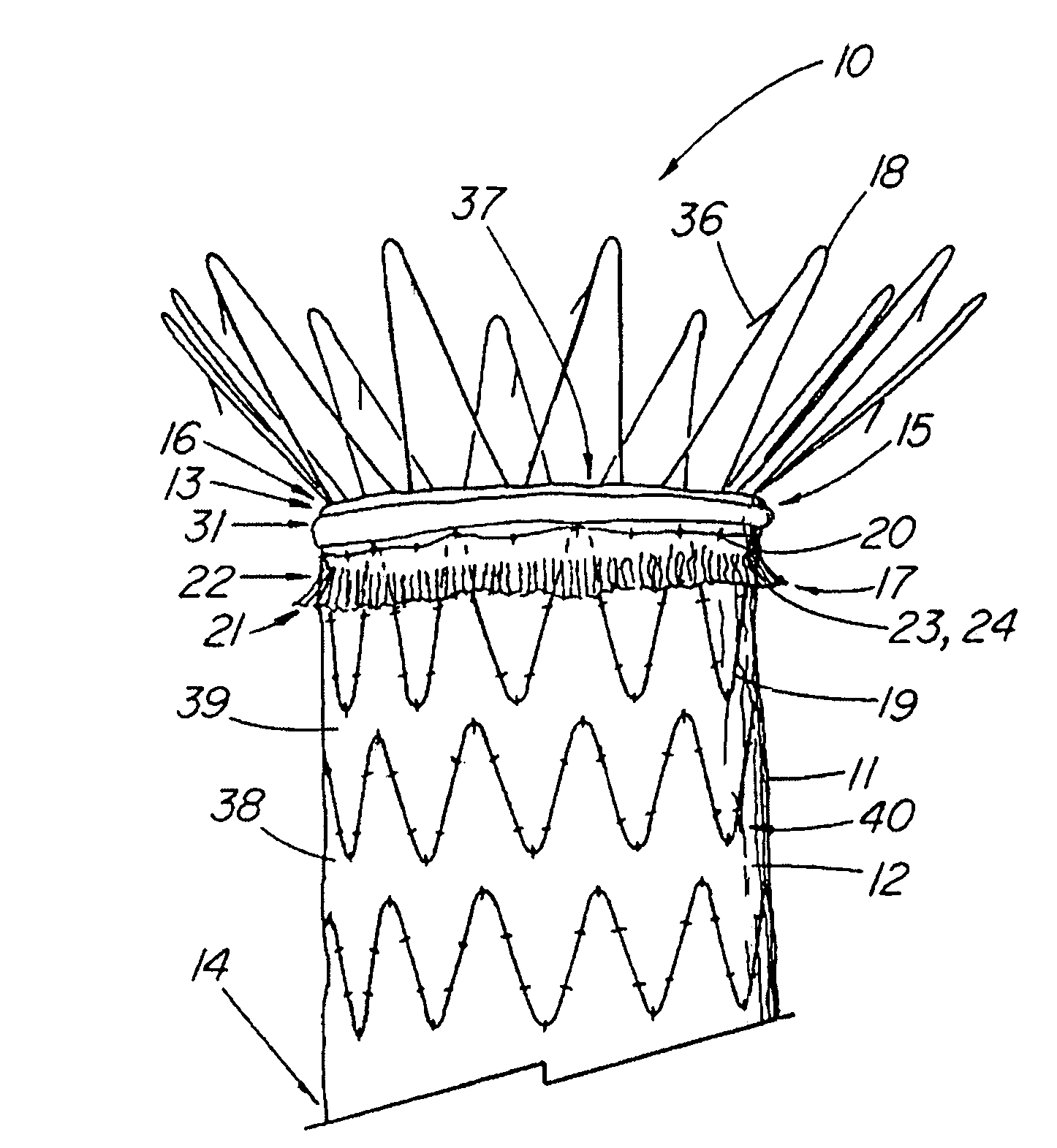 Endoluminal device with extracellular matrix material and methods