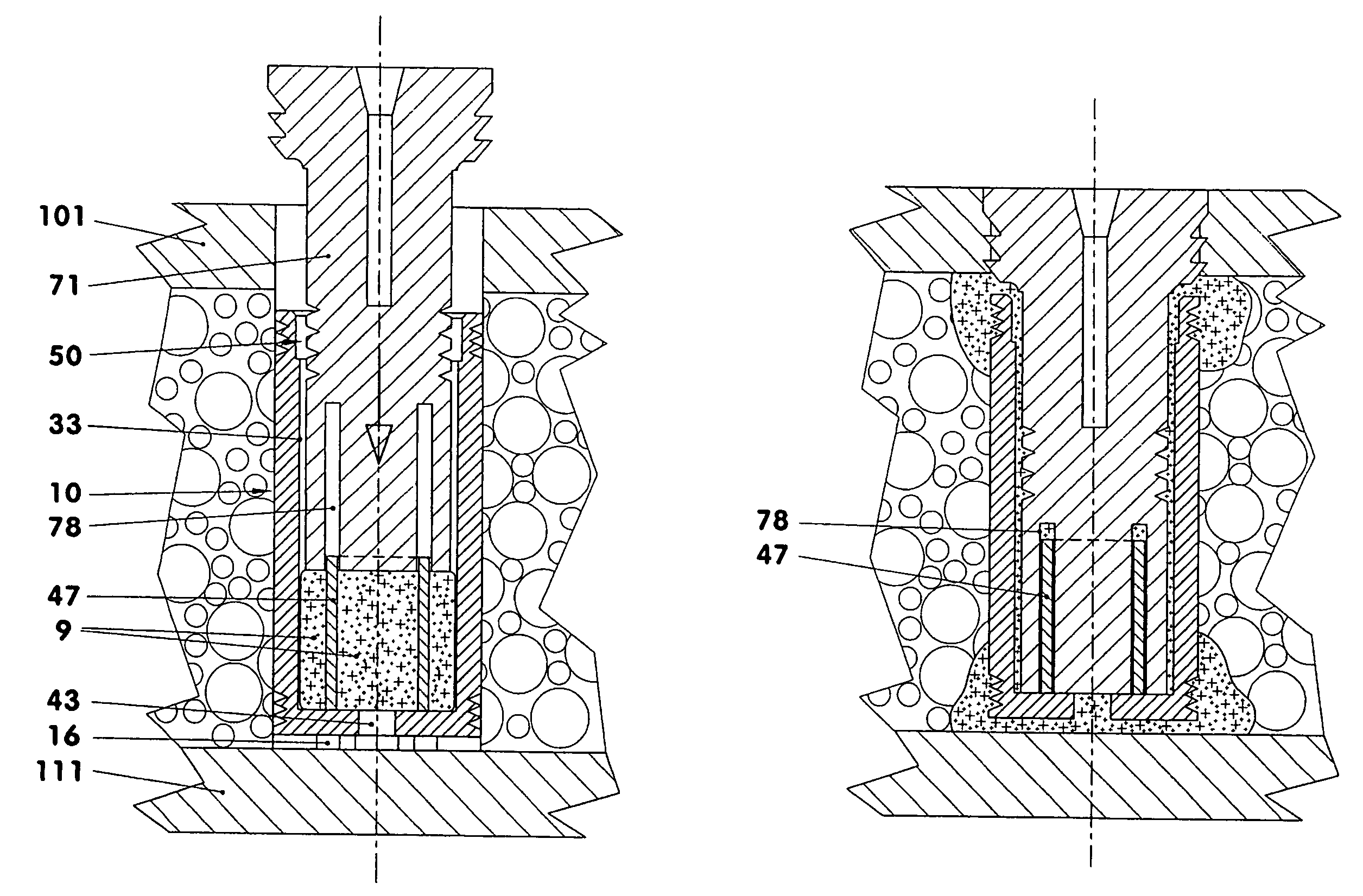 Cement anchor for lightweight construction panels
