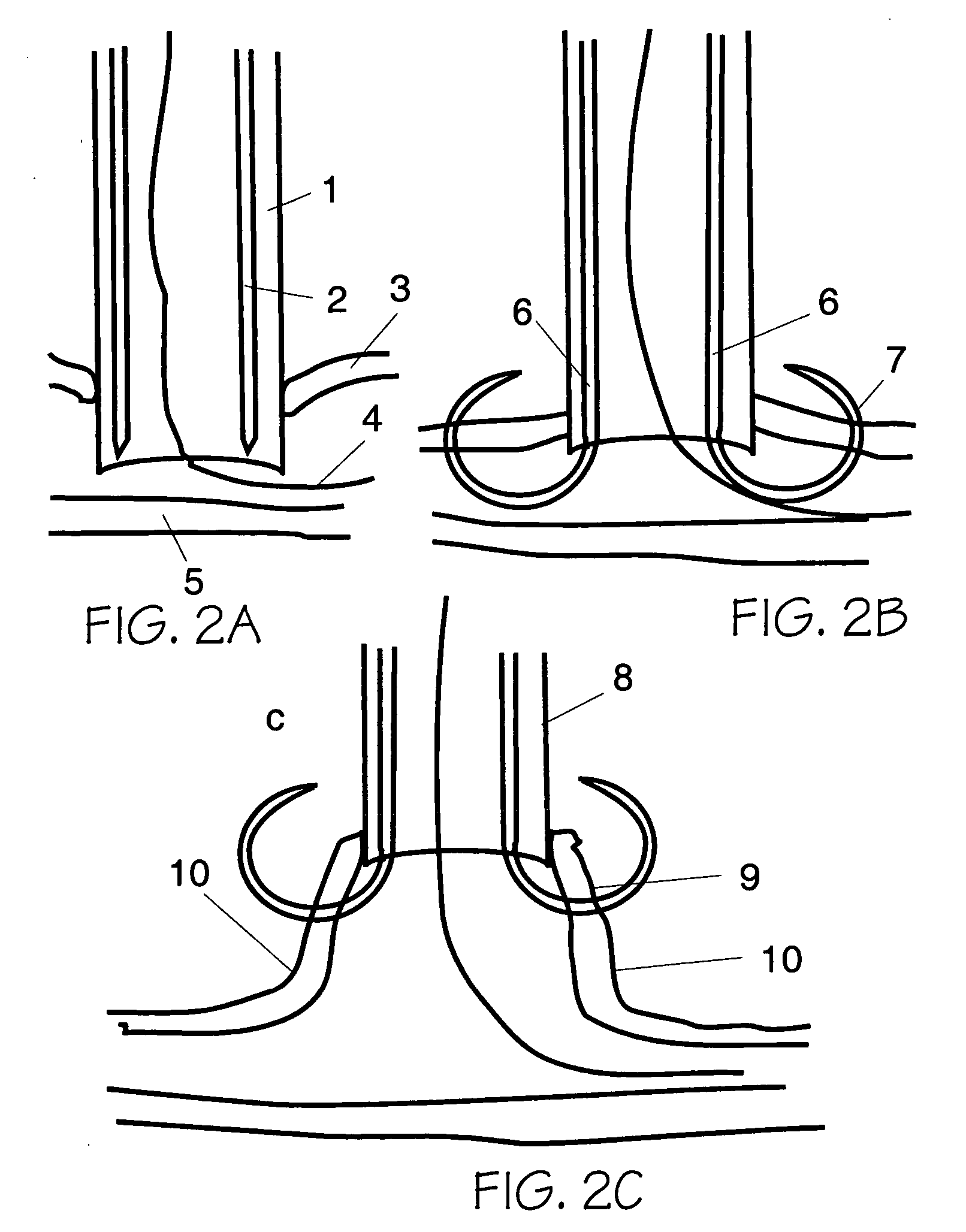 Vascular opening edge eversion methods and apparatuses