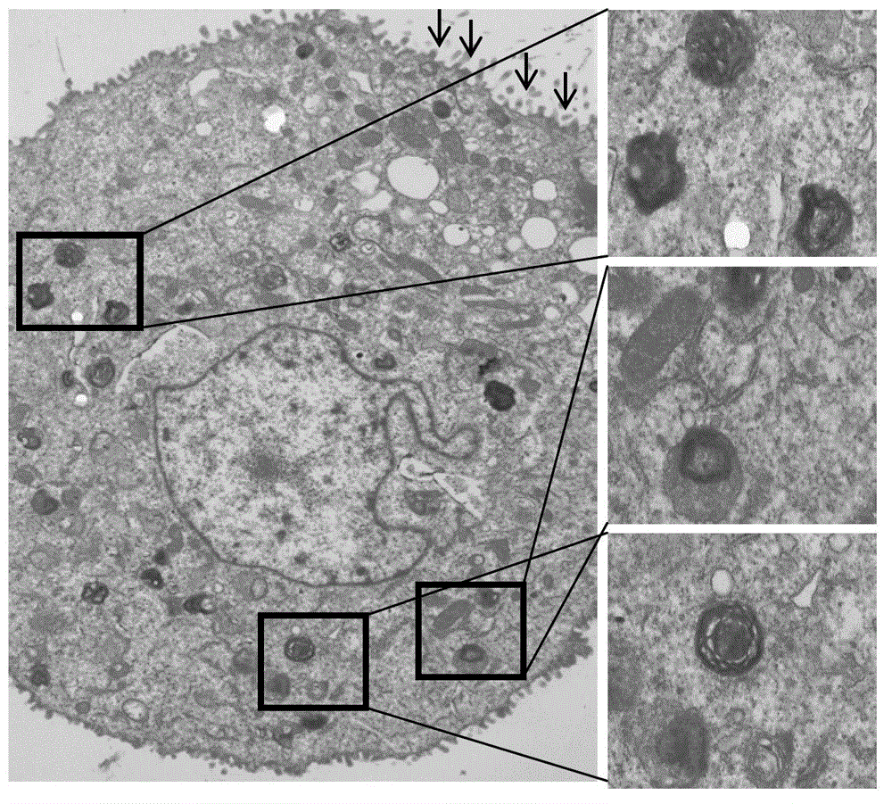 Method for separating and cultivating II-type epithelial cells of people alveolus pulmonis