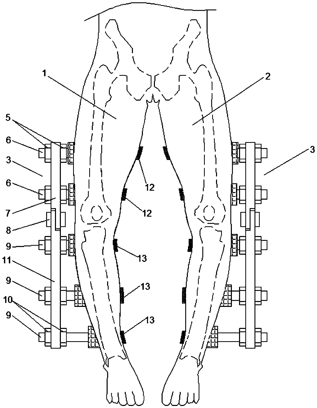 Leg type orthotic device