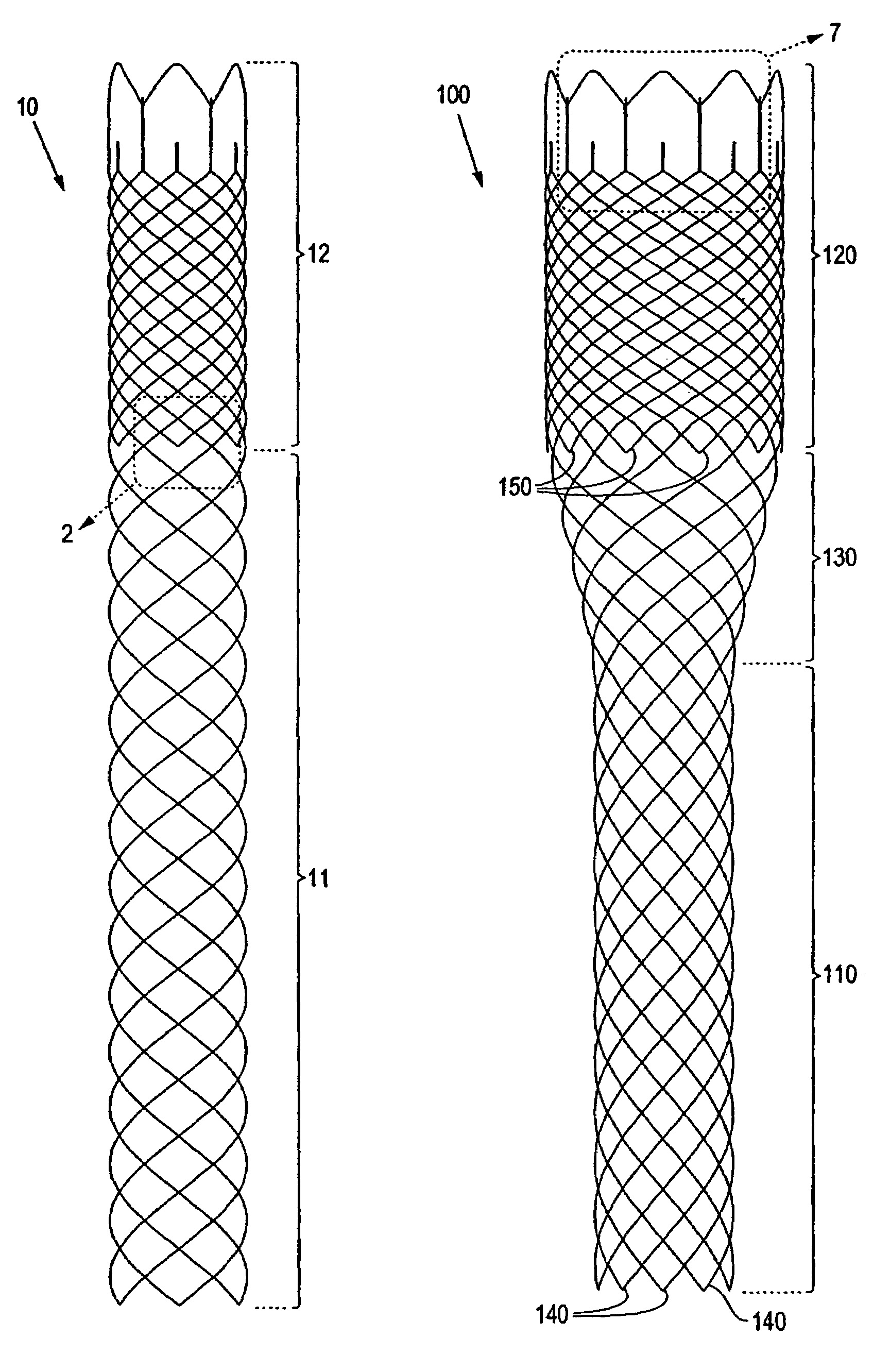 Braided stent method for its manufacture