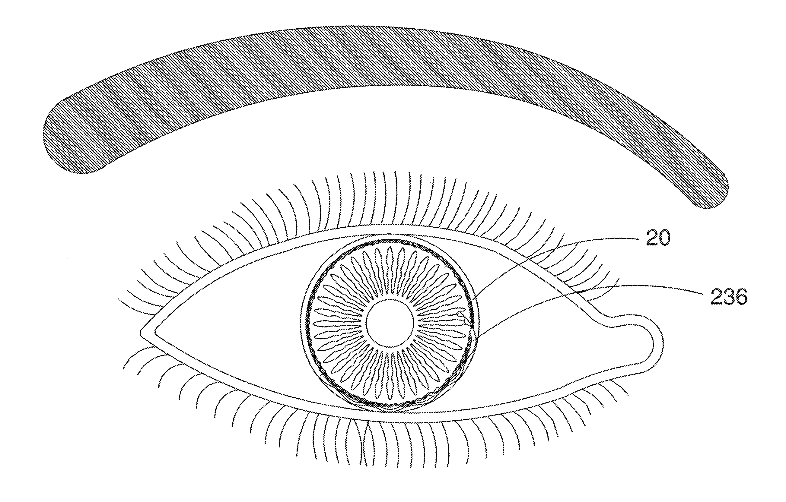 Ocular Implant Architectures